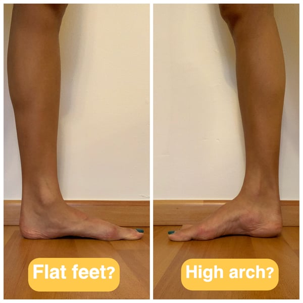 Foot Postures: What It Means for Your Feet?